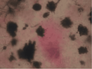 Spleen tissue of Asian fingerling sea bass in Thai Binh infected with Megalo-Macrophages Centres (MMC), specimen observed under a light microscope